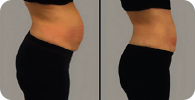 Wonder Axon Before and After