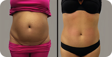 Wonder Axon Before and After
