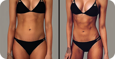 Wonder Axon Before and After